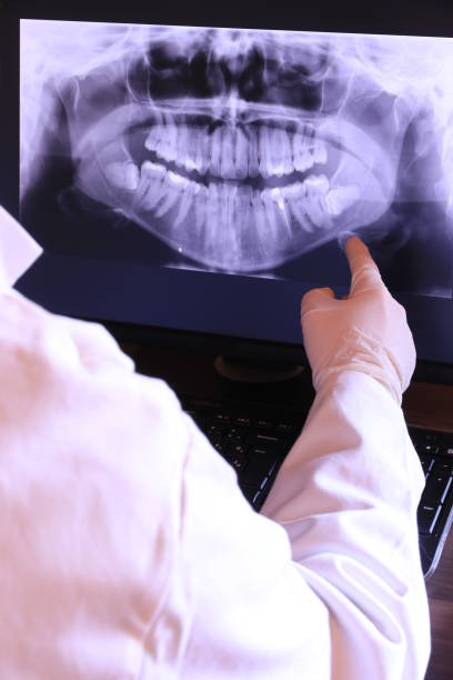 Best Emergency Wisdom Teeth Removal in Marysville, CA
