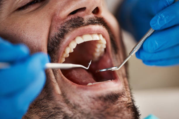 Best Weekend Emergency Dentist in Marysville, CA