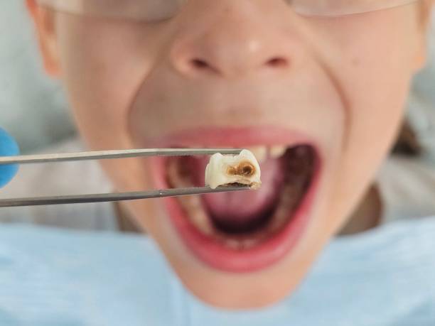 Best Emergency Dental Care for Trauma or Injury in Marysville, CA